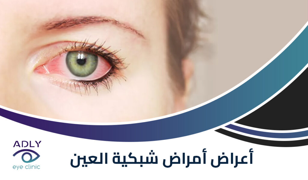 أمراض شبكية العين