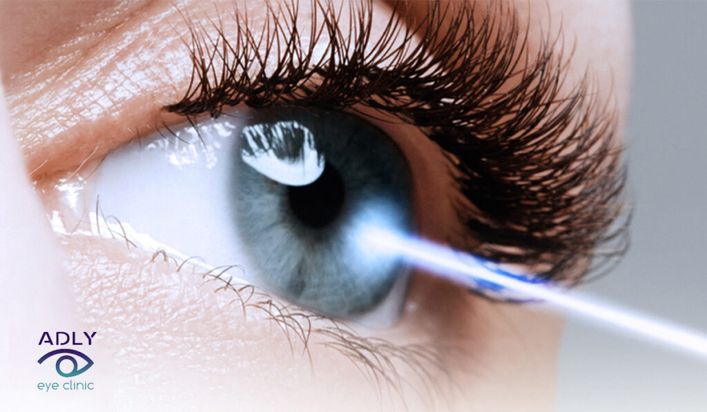 علاج شبكية العين بالليزر