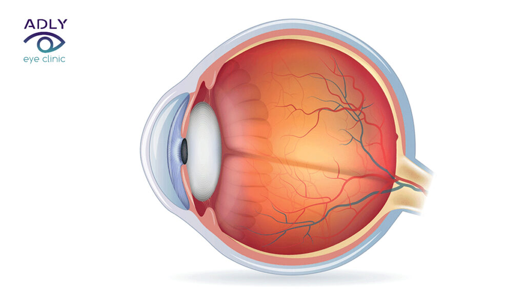 علاج ثقب مركز الإبصار