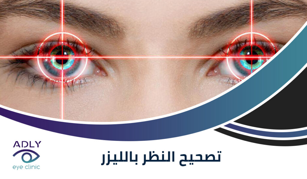تصحيح الإبصار