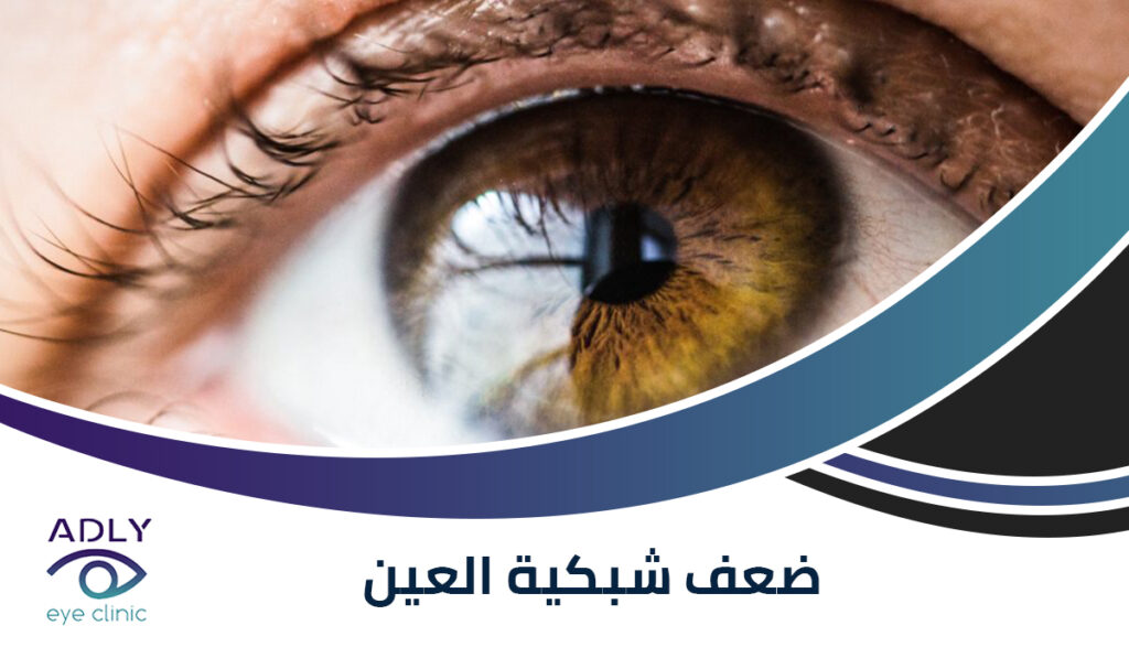 ضعف شبكية العين