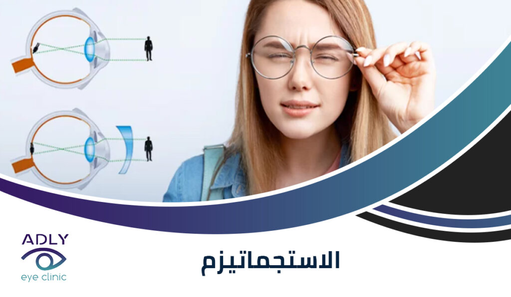 الأستجماتيزم