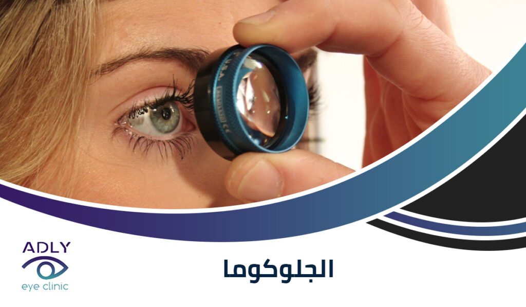 الجلوكوما