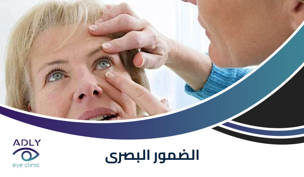 الضمور البصرى