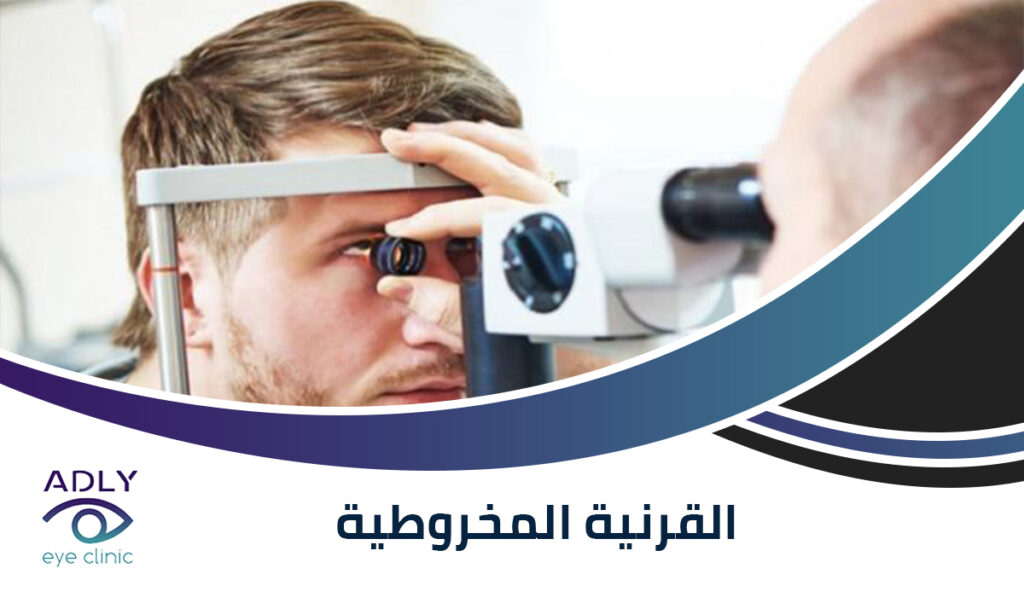 القرنية المخروطية